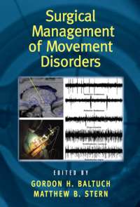 Image of Surgical Management of Movement Disorders