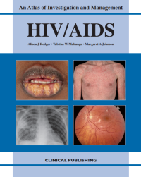 Image of An Atlas of Investigation and Management HIV/AIDS