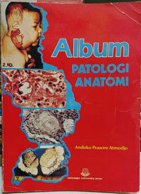 Image of Album Patologi Anatomi