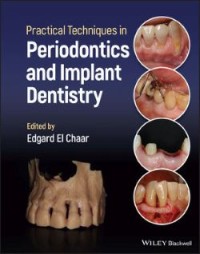 Image of Practical Techniques in Periodontics and Implant Dentistry